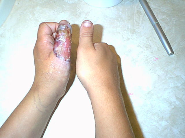 Bailey's thumb1 June 10 2004.JPG [82 Kb]